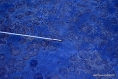 CELLVIZIO GASTROFLEX UHD PROBE CONFOCAL MINIPROBE FOR LASER ENDOMICROSCOPY