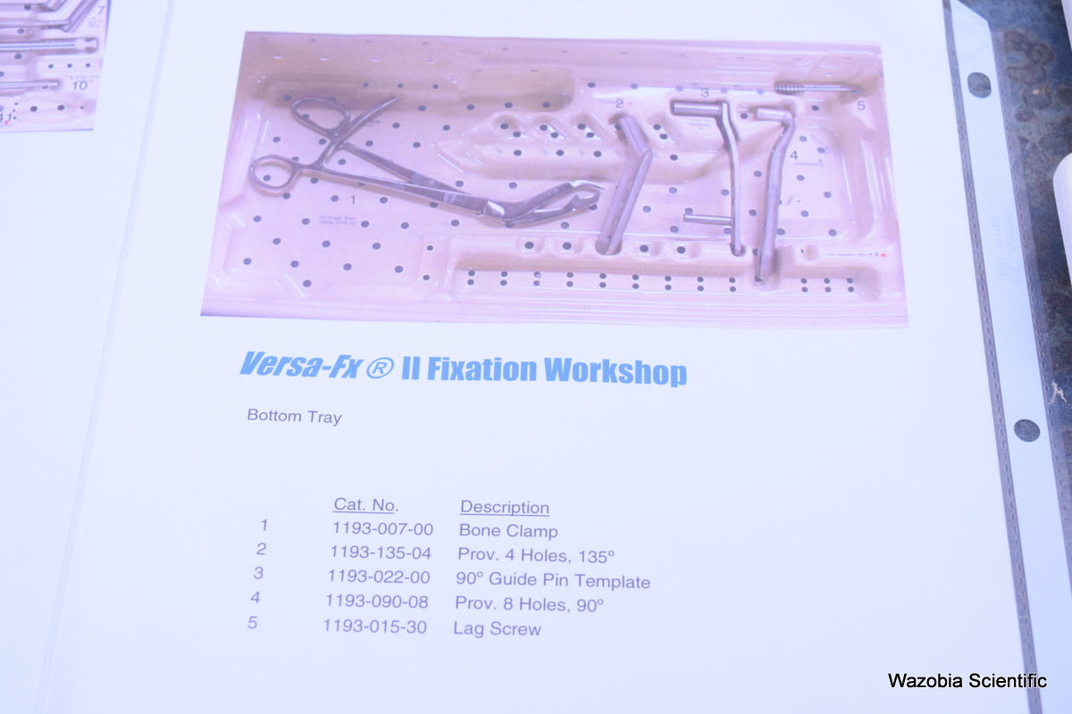 ZIMMER VERSA-FX II FEMORAL FIXATION SYSTEM  FRACTURE MANAGEMENT