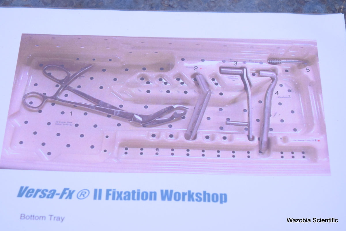 ZIMMER VERSA-FX II FEMORAL FIXATION SYSTEM  FRACTURE MANAGEMENT